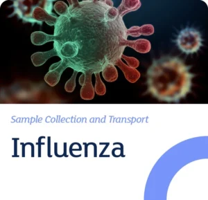 پاکستان میں بھی سپر فلو کہلائے جانے والے انفلوئنزا کی موجودگی کا انکشاف